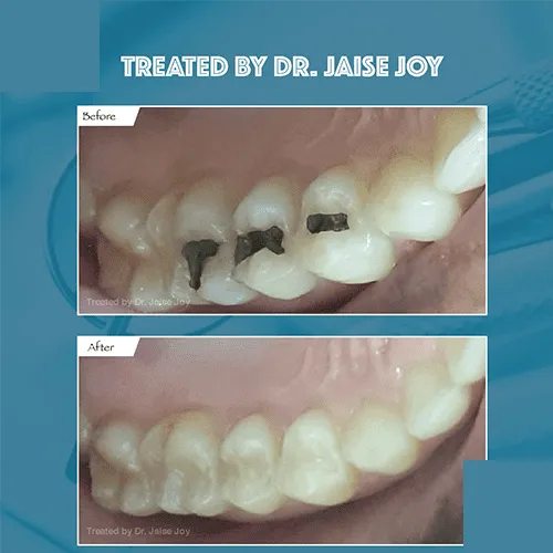 Advanced dental equipment